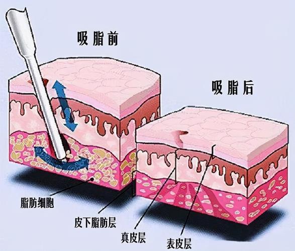 时光飞逝，转眼间我们已迈入2025年。眼瞅着春节又要临近，不少爱美的小姐姐们是不是又开始琢磨着，如何才能在阖家团圆时，以较惊艳的状态亮相呢？想要悄悄变美，又担心价格不透明？别急，